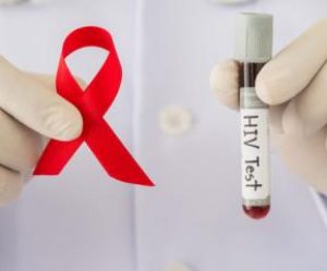 Situación del SIDA en El Salvador 2018